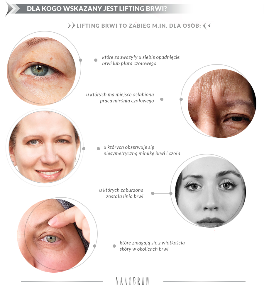 Pięć zdjęć ze zbliżeniami oczu i twarzy osób, dla których wkazany jest lifting brwi