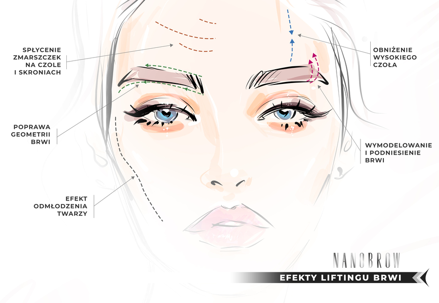 Lifting brwi - na czym polega ten zabieg?